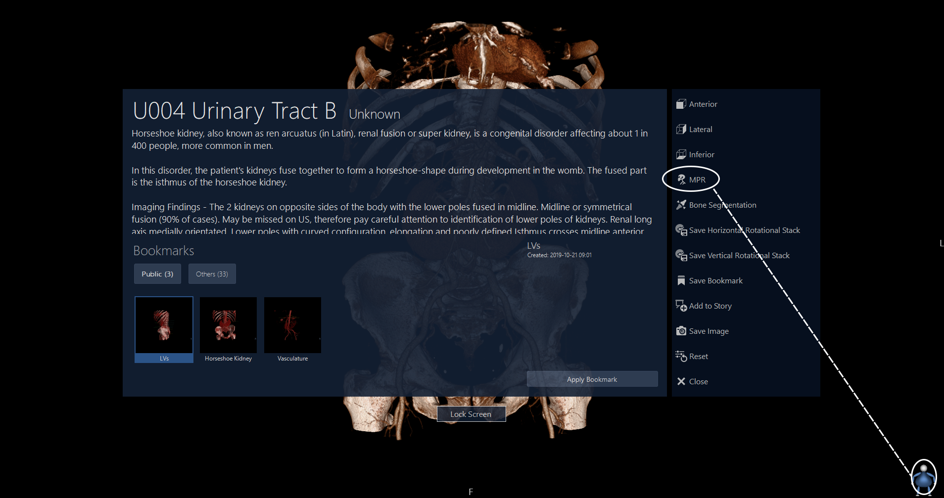 MPR and 3D mode – Resource Hub